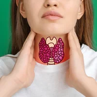 maladie-de-graves-basedow