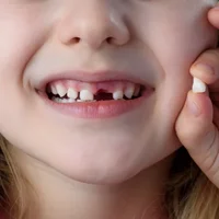 microdontie-dents-de-petite-taille