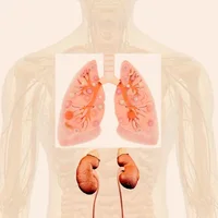 syndrome-goodpasture