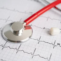 Arythmies cardiaques