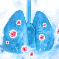 infections-pulmonaires