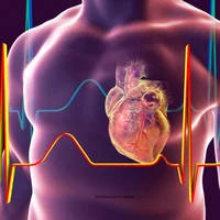 Insuffisance coronaire