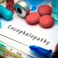 encephalopathie-de-wernicke