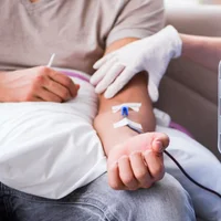 fistule-arterio-veineuse