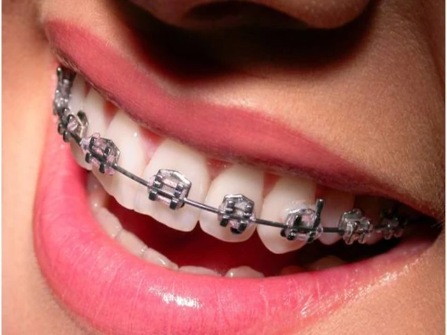 Docteur AHLEM HELIMET HAPPY DENTAL