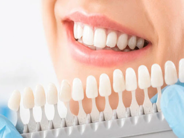 Docteur AFAF MERAD DALILA SMILE
