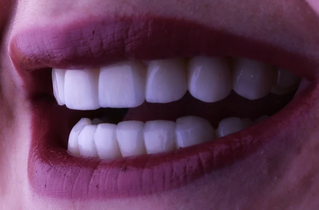 YOUNES  ALPHA DENTAL