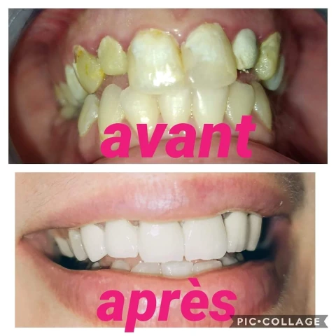 AF1QipMJa7-vQtktiiDxBCxRavEwY5VyhOcoeODechqMw1920-h1080-k-no.webp