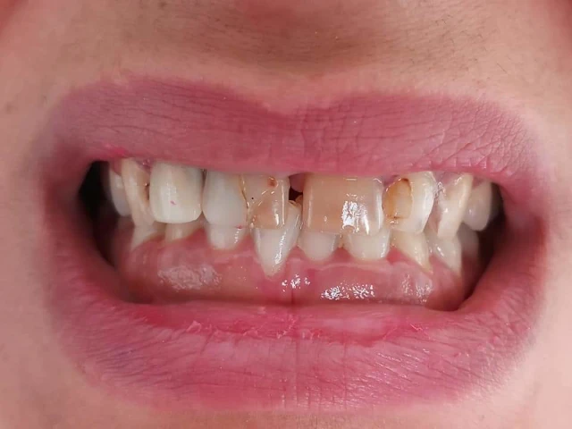 AF1QipN7fPclrnoeNxX5taF4_GjSjDQyQexnjV8c-dfZw1920-h1080-k-no.webp