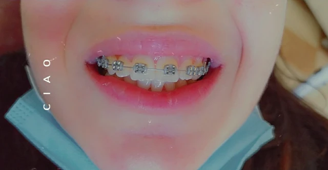 AF1QipNbAE4tzUJKlU5D7ipWtFcpoWRdiqls6Si4BGVjw1920-h1080-k-no.webp