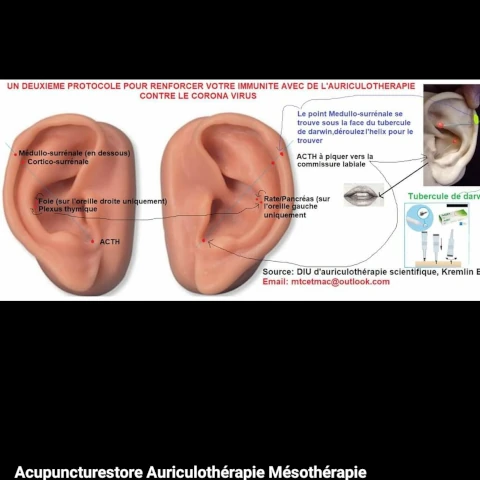 AF1QipNvAD-XjwF52As6s9cxy9afFeO5cu8svwaHQbF8w1920-h1080-k-no.webp