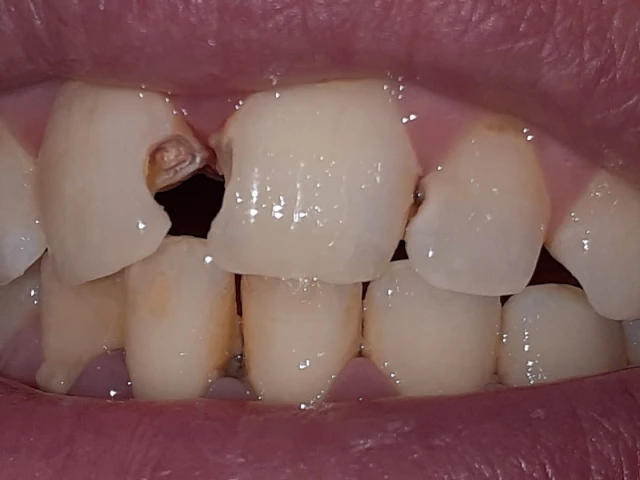 AF1QipOrxhkC_tGbL8NX5o2eX396g4qi2wltyv5qitRkw1920-h1080-k-no.webp