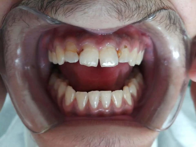 AF1QipPIrd4iS2ys6lE_RHKZalALQvOLMRuotv3A-R9Xw1920-h1080-k-no.webp