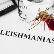 Leishmaniose