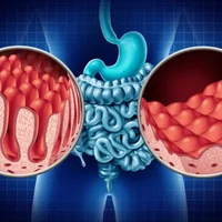 Malabsorption intestinale