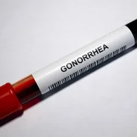 Gonorrhée  