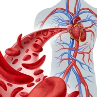 Troubles de la circulation sanguine (artériopathie)