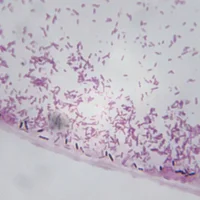 Infections à Clostridium