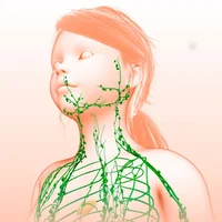 Lymphome de Hodgkin