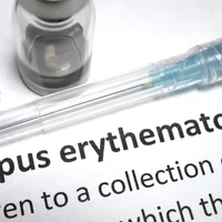 lupus-erythemateux-systemique